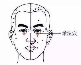 一、  印堂穴的治疗功效与临床应用