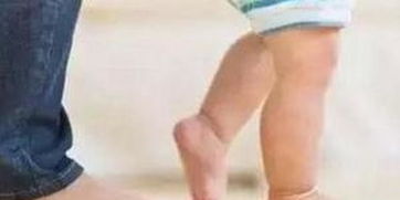 小孩八字脚图片大全，有哪些儿童脚踝畸形图片可以参考？