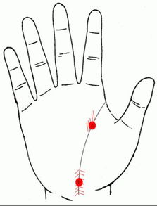 2. 掌心（即生命线或感情线附近）有痣——吉凶两分的“双向”意义