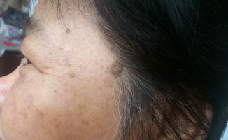 一、  毛发生长的组织学基础与生理机制