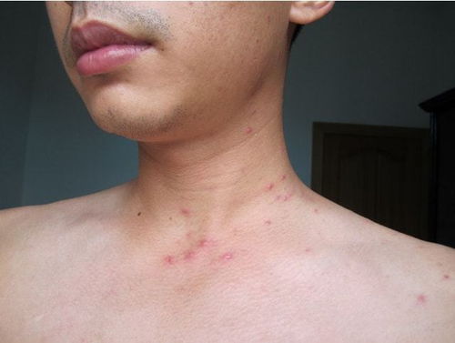 2. 眼白有痣：强烈的异性吸引力与不稳定性