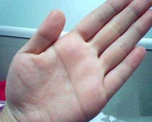 真实伪辨析：先天断掌与虚虚假断掌