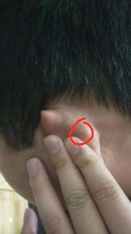 “双耳小”与“面形尖”相结合的综合解读