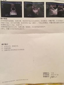 三、 医学恢复期内的生活方式提议