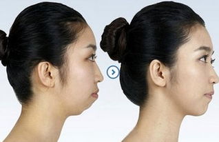 鼻头靠近嘴唇：情绪化依赖与易累感的根源