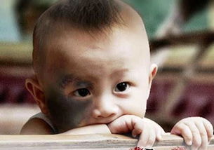 1. 眼尾奸门：婚姻与家庭运势的晴雨表