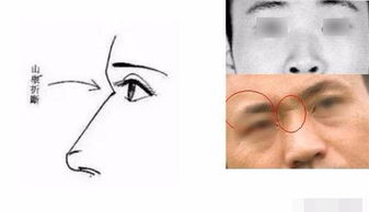 恶痣刀疤与气色黑暗：出行警惕与阴灵侵扰