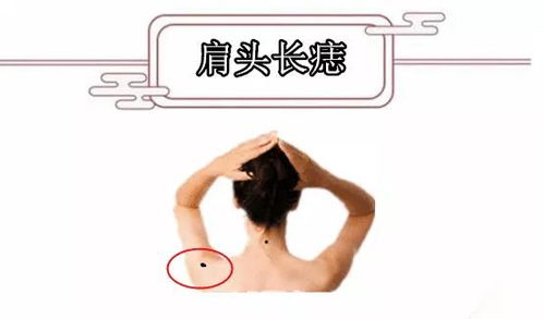 一、  足部之痣：忠诚品格与权力象征的统一