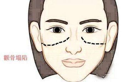 9. 驿马区（眉间）色泽变化