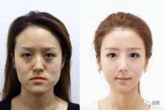 2026年本命年割双眼皮推荐吉日是哪一天？整容吉日如何选择？