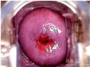 选择合适的医院和医生：关键所在