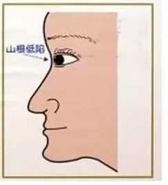 鼻子与夫妻感情