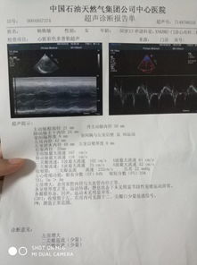 一、 二尖瓣与三尖瓣反流的定义与诊断依据