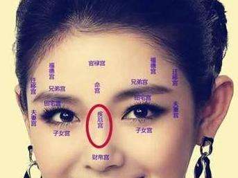 男性山根有纹，与八字纹结合，这是否意味着某种特殊含义？