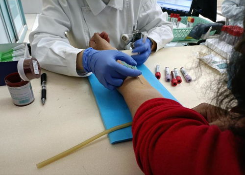 梦见抽血为什么会流彳艮多血，这代表着什么含义？