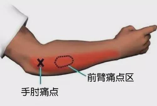 典型案例分析：张先生的康复历程