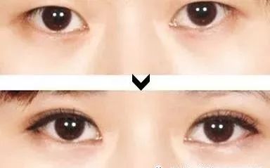 左眼皮跳动的医学机制