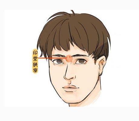 早发横纹额头：青年时期运势受阻导致感情多变