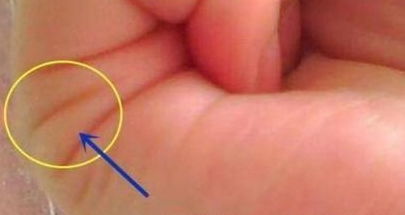 4．面容细节对应婚配风险