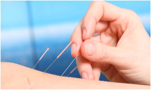 针灸大夫八字特征有哪些？国家公认十大针灸流派是哪些？