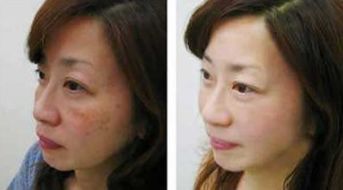 眉间黑点：运势转机的信号