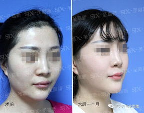 ：面相学中颧骨高耸的符号学意义与社会误读