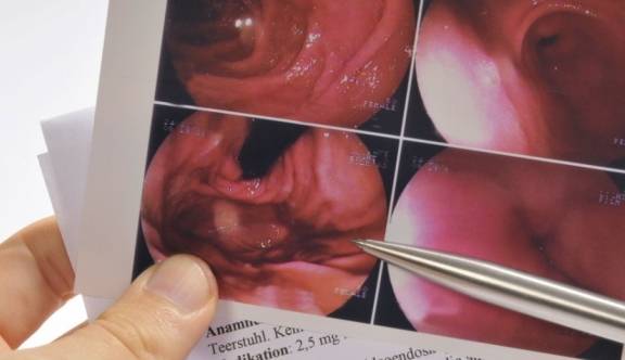 寒冬必看！这4种神奇食物让你咳痰全消 家家都有却没人知道