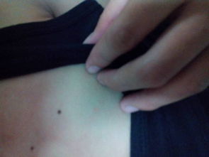 三、  女性左手腕长痣的相学分析：内在坚韧与命运轨迹的独特隐喻