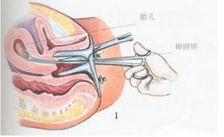 婴灵之境：中阴天与灵魂交流