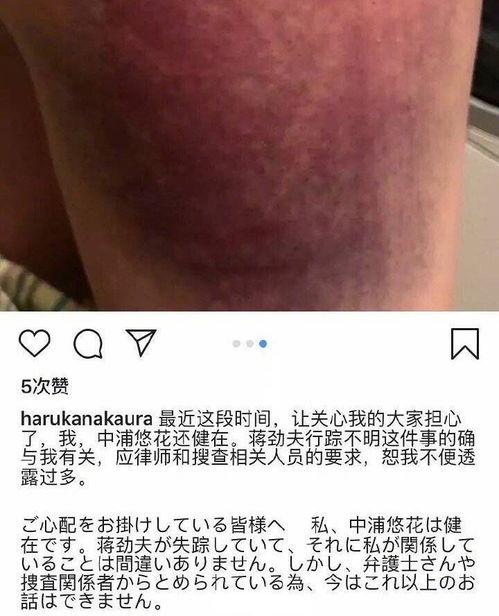 2.3 喉核上的痣：兄弟姐妹间隙难消