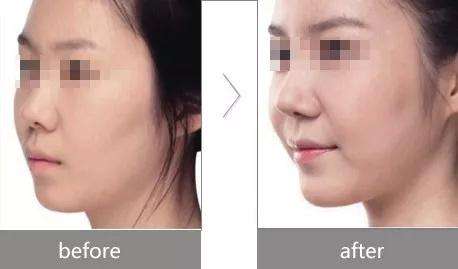 （二）有肉有骨：吉相的判定标准