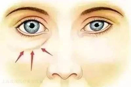 三、“阴阳脸”形成的外在诱因