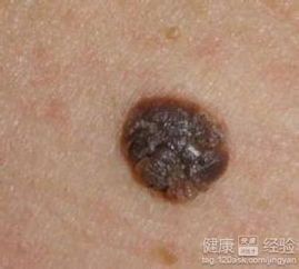 3. 超声波检查（Ultrasound）