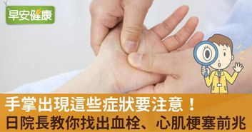 一、 智慧线分叉的基本形态与描写