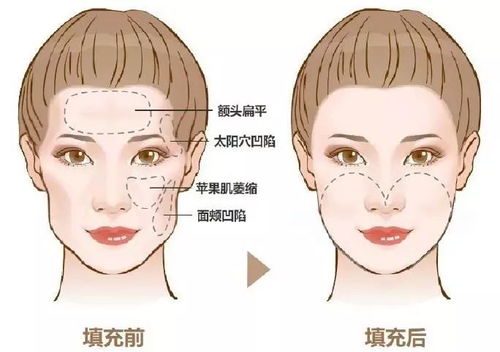 “权骨”与“命骨”的解读