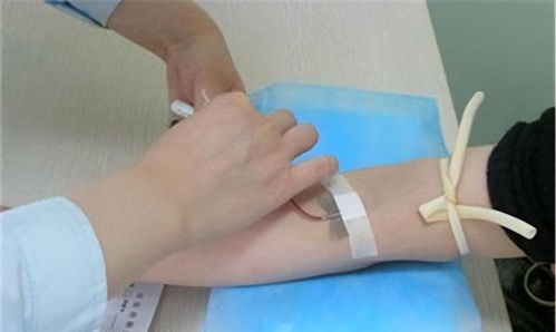 女人梦见别人抽血是什么不祥的预兆？