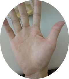 断掌与隐私保护及生命平安