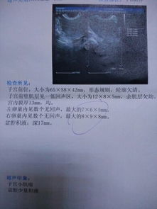 排卵试纸：一种辅助方法