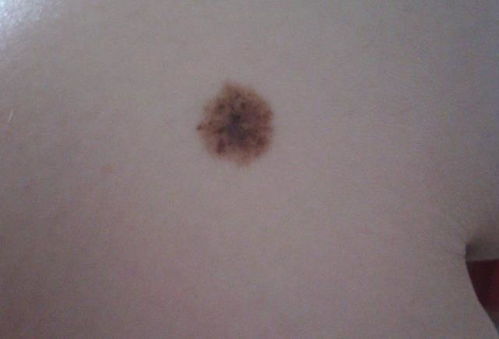 ：人体体表标记的生理学阐释与传统文化隐喻