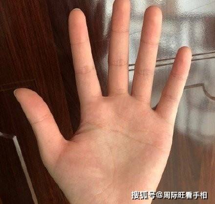 第一章 生命線與營養狀況之關聯性解析