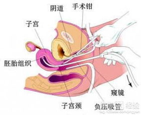 刮宫7天后同房会不会怀孕？