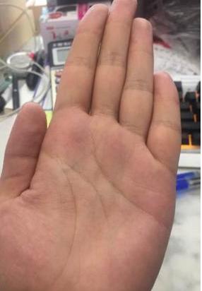 有哪些罕见手相图片及其解读方法？