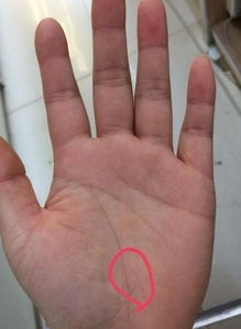 手相中哪些特征能反映出一个人可能存在脾虚问题？