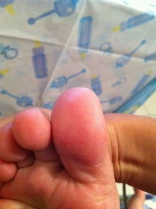 女性二拇指比大拇指长，这究竟意味着什么？