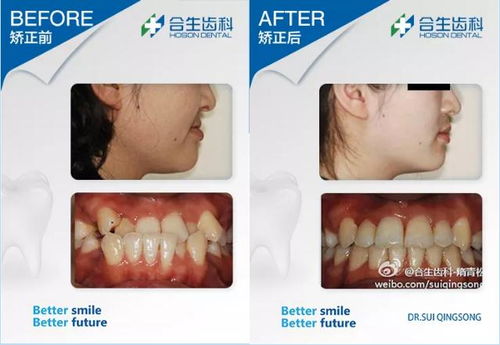 二、  生理与心理的双重困境：缺牙对个体命运的实质性影响