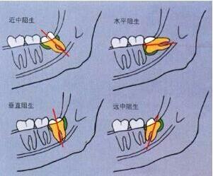 齿牙餘論是哪个生肖？打一生肖是什么生肖？