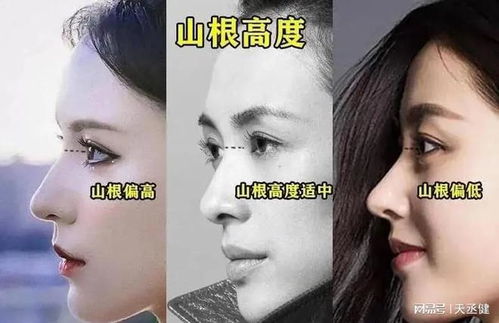 山根普通但鼻梁直、鼻头大且饱满下垂：注重物质基础的选择