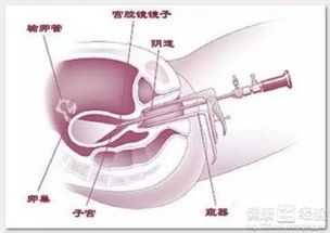 异常情况