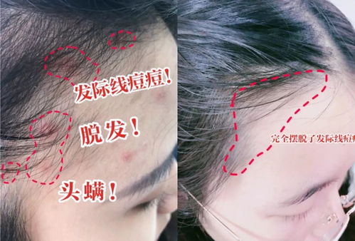 头发浓密乌黑：气血充盈的表现