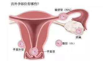 从理论上讲来说……确实有一定相关性！不过别慌哈~~听我缓慢缓慢道来……